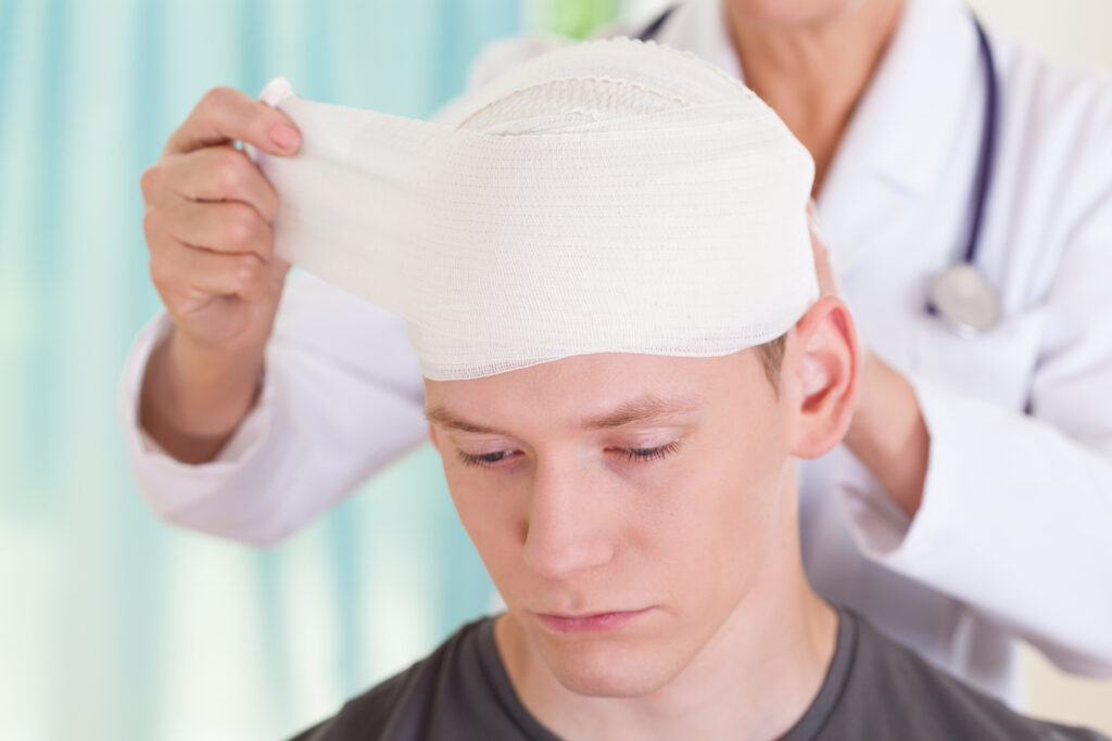 Delayed Concussion Symptoms